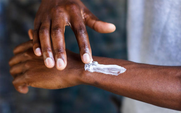 Moufense – Malariaschutz für die Menschen vor Ort